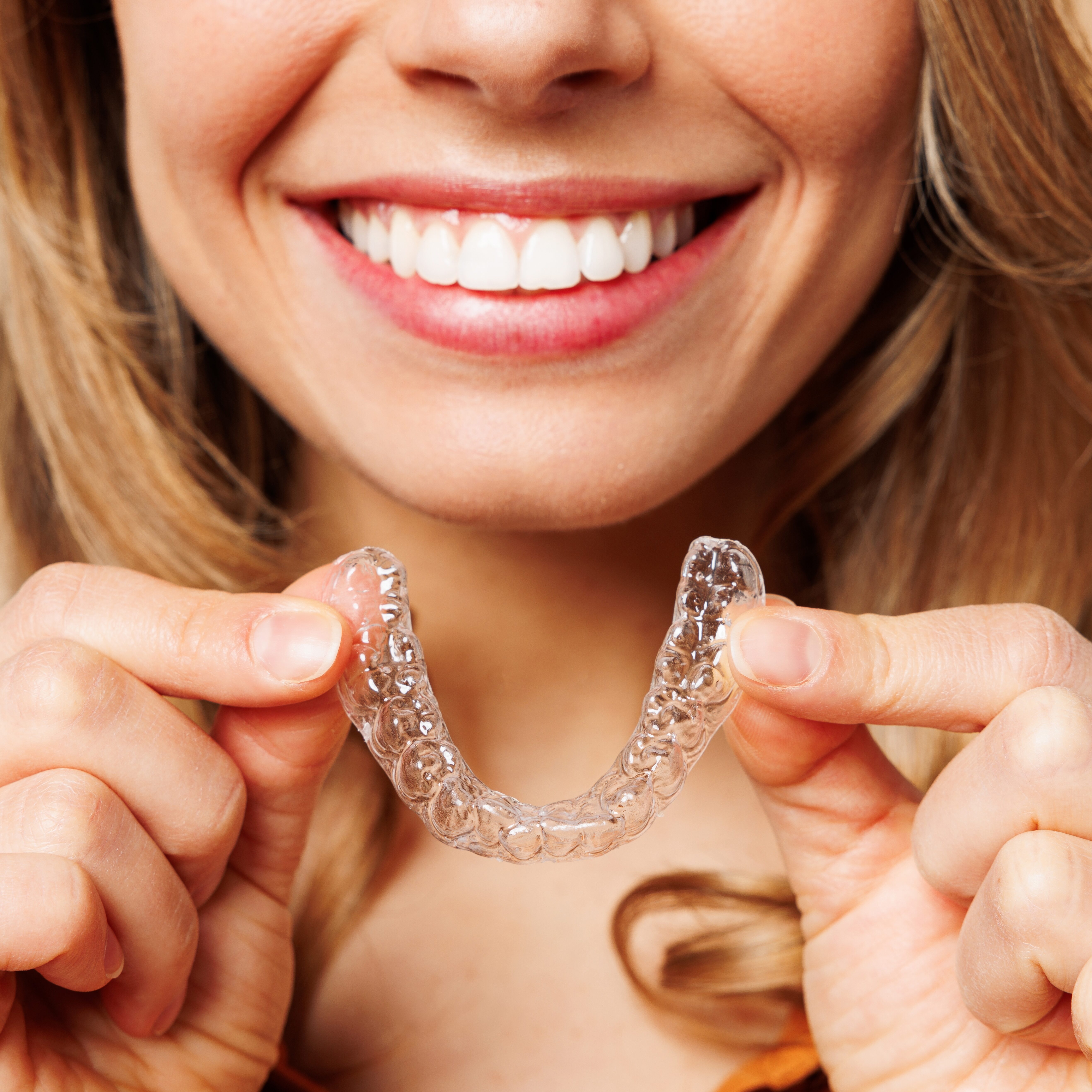 invisalign eagle mountain